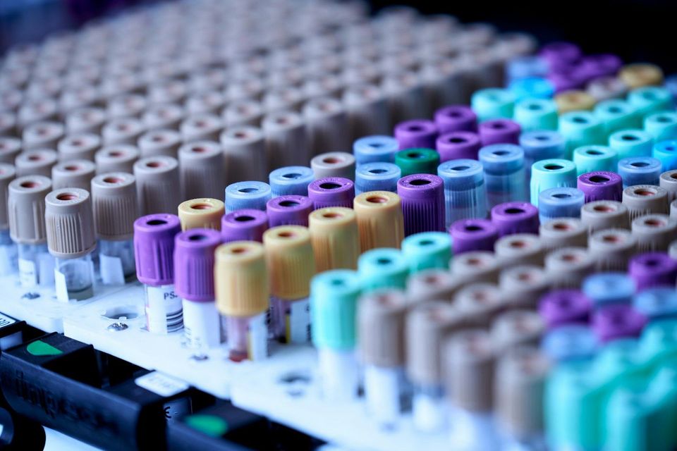 Rows of blood-collection tubes in a laboratory rack